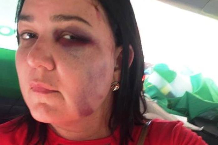 Mulher denuncia agressão após declarar voto