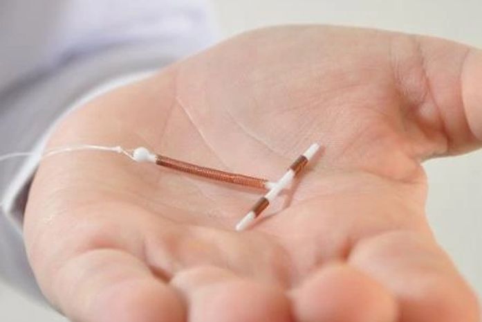 "É uma situação totalmente abusiva e ilegal", diz advogado alagoano sobre exigência de consentimento de marido para DIU