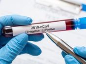 Covid-19: Alagoas tem 75.857 casos confirmados e número de óbitos sobe para 1.818