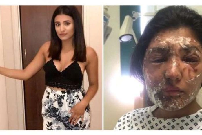 Resham recebeu elogios por seus relatos nas redes sociais que 'inspiram a milhões'