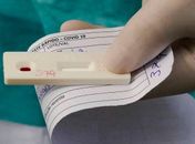 Com 47 notificações nesta sexta-feira (11), Arapiraca chega aos 10.945 casos de Covid 19