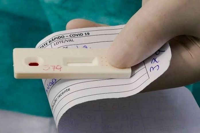 Com 47 notificações nesta sexta-feira (11), Arapiraca chega aos 10.945 casos de Covid 19