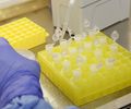 Casos de síndrome respiratória aguda crescem com menos intensidade