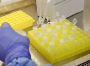 Casos de síndrome respiratória aguda crescem com menos intensidade