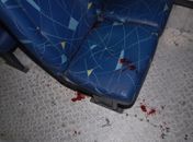 Manchas de sangue no ônibus 