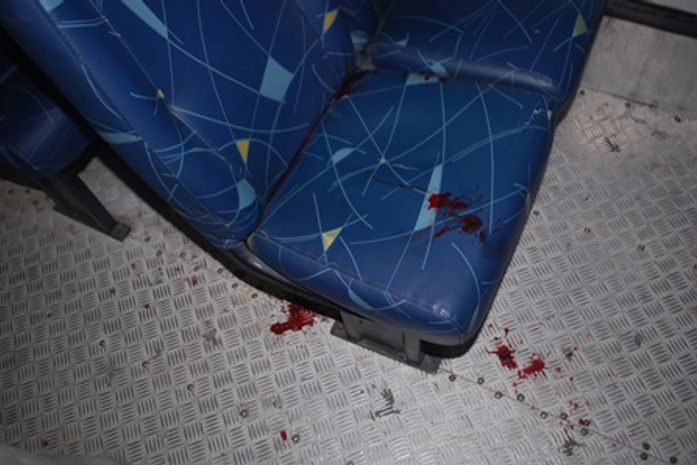 Manchas de sangue no ônibus 