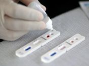 Covid-19: casos ficam estáveis e mortes apresentam leve queda