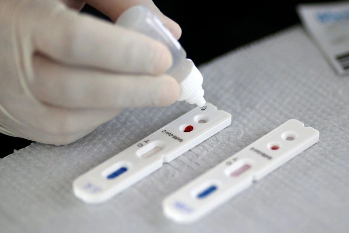 Covid-19: casos ficam estáveis e mortes apresentam leve queda
