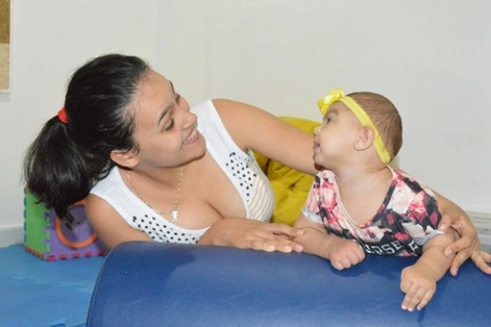 Secretaria de Saúde oferece atendimento humanizado a crianças com microcefalia