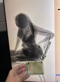 Body scanner flagra mulher com seis celulares e maconha escondidos em visita a presídio de Maceió
