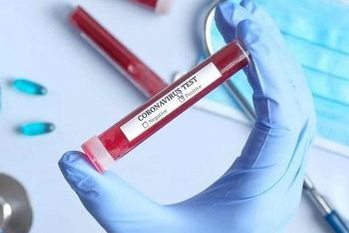 Teste para Covid-19