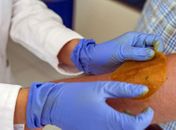 Novo adesivo regenera pele de diabéticos e evita amputação