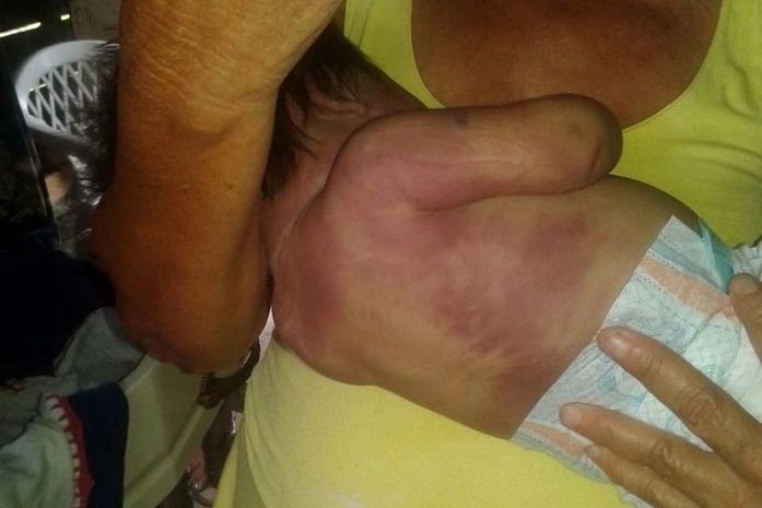 Por não aceitar ter filha mulher, pai espancou e matou a bebê. Infantícidio? Feminicídio?