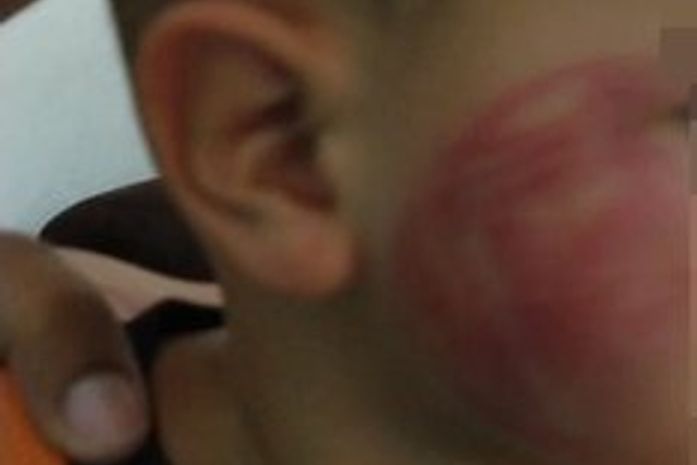 Padrasto fugiu após agredir menino com chineladas no rosto.