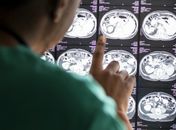 Santa Casa de Maceió abre seleção para aperfeiçoamento em tomografia e ressonância magnética