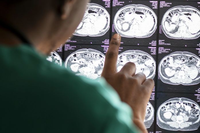 Santa Casa de Maceió abre seleção para aperfeiçoamento em tomografia e ressonância magnética