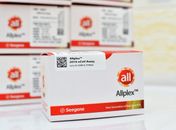 Lacen/AL aumenta estoque de kits RT-PCR para ampliar diagnósticos