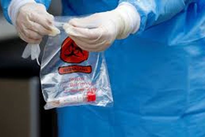 Brasil registra 31.553 novos infectados por Covid-19 em 24h e ultrapassa 5 milhões de casos acumulados; foram 734 óbitos no mesmo período