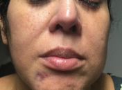 Vítima afirma que foi agredida com socos e ameaçada com faca