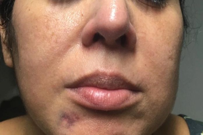 Vítima afirma que foi agredida com socos e ameaçada com faca