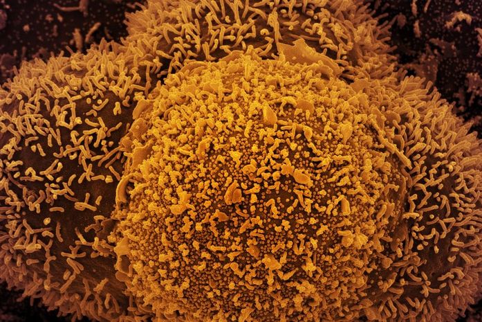 Covid-19: consórcio do Nordeste recomenda cancelamento do feriado de carnaval