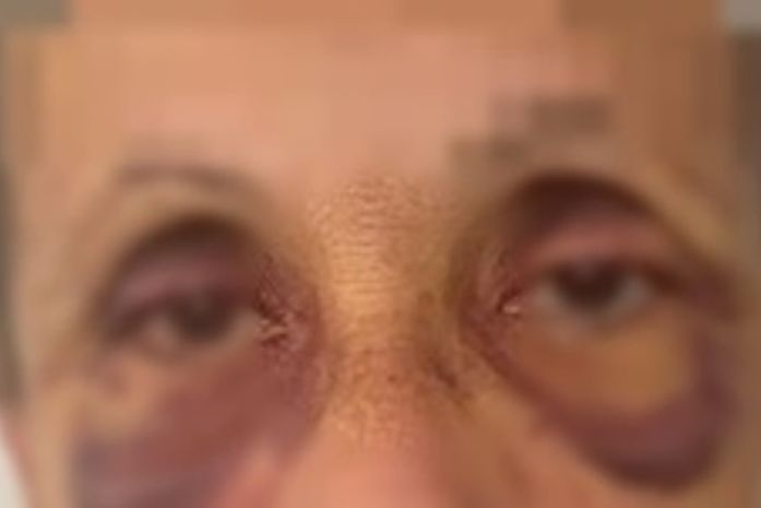 Mulher apresentava machucados no rosto e no corpo quando foi à polícia.