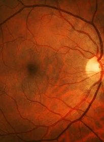 Família alagoana mobiliza campanha solidária para custear atendimento especializado de mulher diagnosticada com doença rara da visão