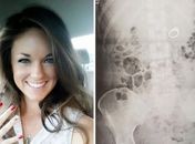 A noiva sonhou que precisava proteger o anel de bandidos em um trem em alta velocidade