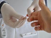 Julho Amarelo: testes para diagnóstico de hepatites, HIV e Aids iniciam neste sábado (3)