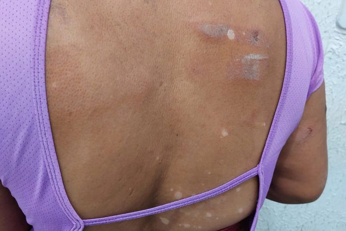 Jovem é preso após agredir companheira com ripa de madeira no interior de AL