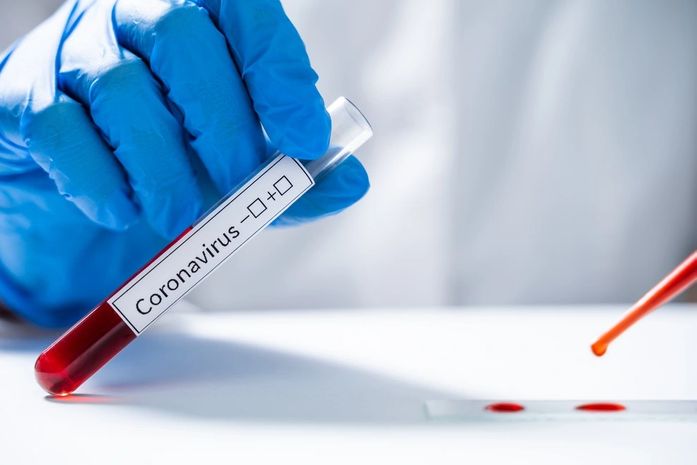 Covid-19: Alagoas registra mais 58 casos e duas mortes
