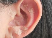 Minha Experiência: “A auriculoterapia me fez perceber que precisava olhar mais para mim”