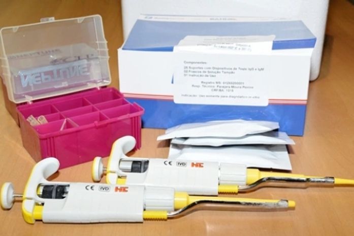 Com o teste rápido de Zika será possível identificar infecções recentes ou antigas pelo vírus em gestantes e recém-nascidos, até seis meses de vida