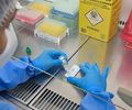 Resolução da Anvisa define regras para laboratórios públicos e privados alagoanos
