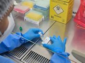 Resolução da Anvisa define regras para laboratórios públicos e privados alagoanos