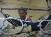 Prática que ajuda a salvar bebês prematuros completa 40 anos