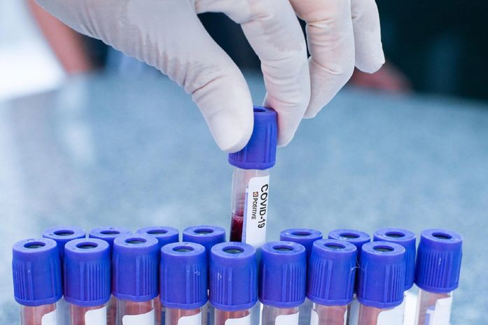 Testes para Covid-19