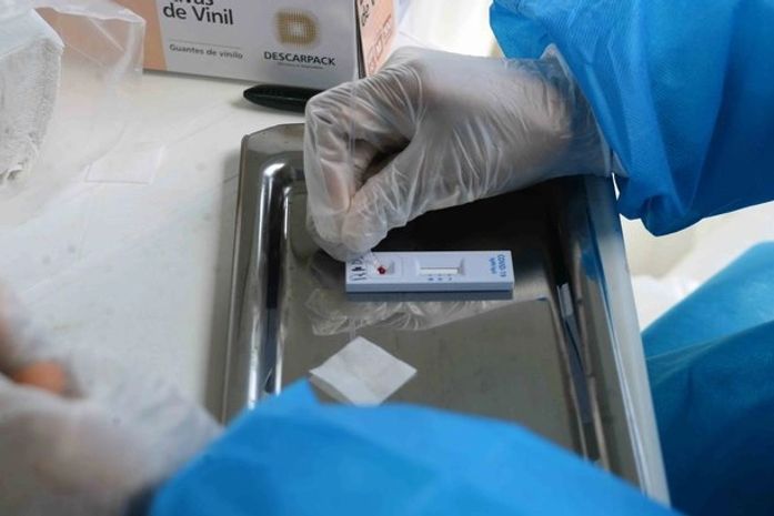 Com média móvel de 25,5 mil, casos de Covid-19 no País mantém tendência de alta