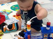 Bebê de Murici enfrenta nove paradas cardíacas e amputações; família pede ajuda
