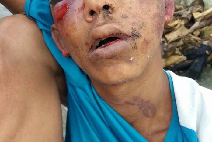 Muitos filhos de juiz, político, policial fumam maconha, e por que a polícia só prende gente pobre e preta, como meu filho? -Pergunta a mãe.