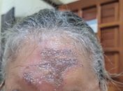 Vigilância Sanitária apreende óleo que teria causado queimaduras em fiéis durante celebração religiosa