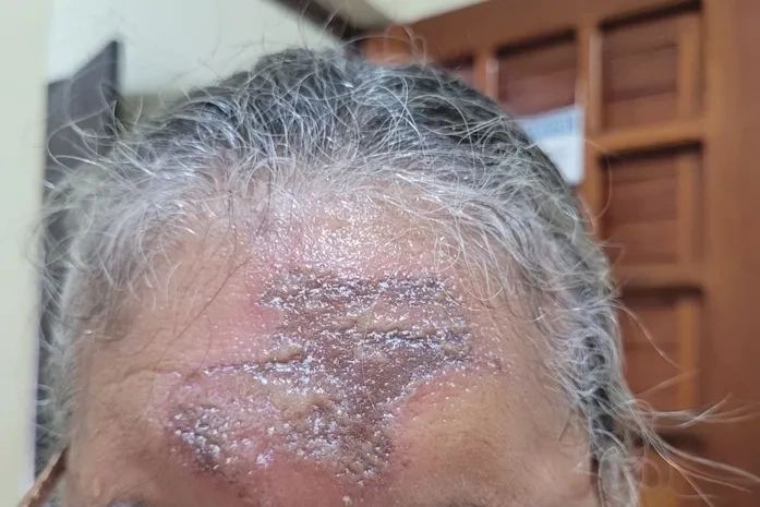 Vigilância Sanitária apreende óleo que teria causado queimaduras em fiéis durante celebração religiosa