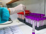 Taxa de transmissão da covid-19 no Brasil cai para 1,01, diz estudo