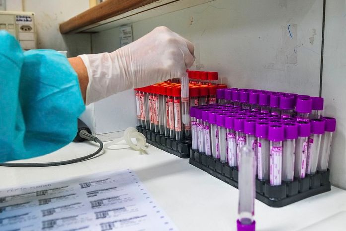 Taxa de transmissão da covid-19 no Brasil cai para 1,01, diz estudo