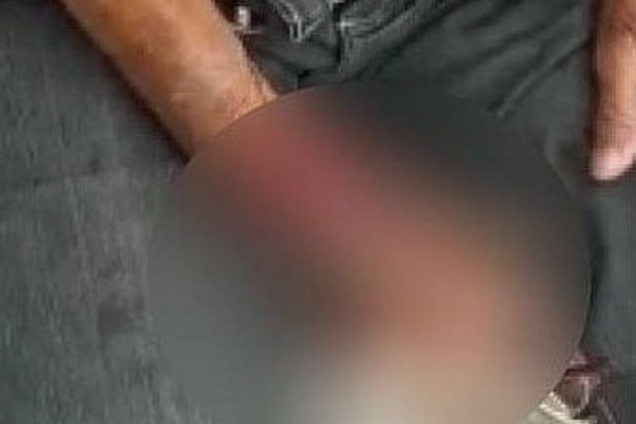 Idosa ficou ferida após ser atropelada por carro e moto na Ponta Verde, em Maceió