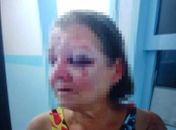 Filho é indiciado por espancar a própria mãe em Campo Alegre