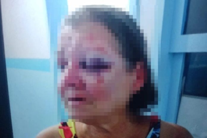 Filho é indiciado por espancar a própria mãe em Campo Alegre