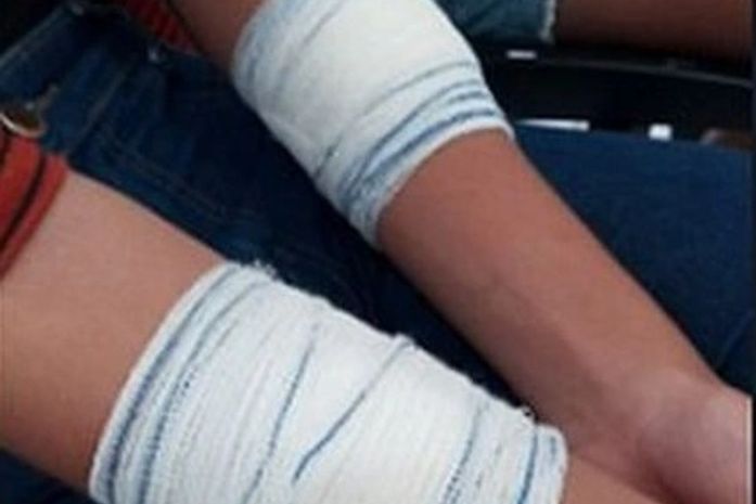 Adolescente sofreu cortes de estilete nos braços