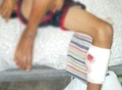 Meninos focavam baleados enquanto brincavam na frente de casa.