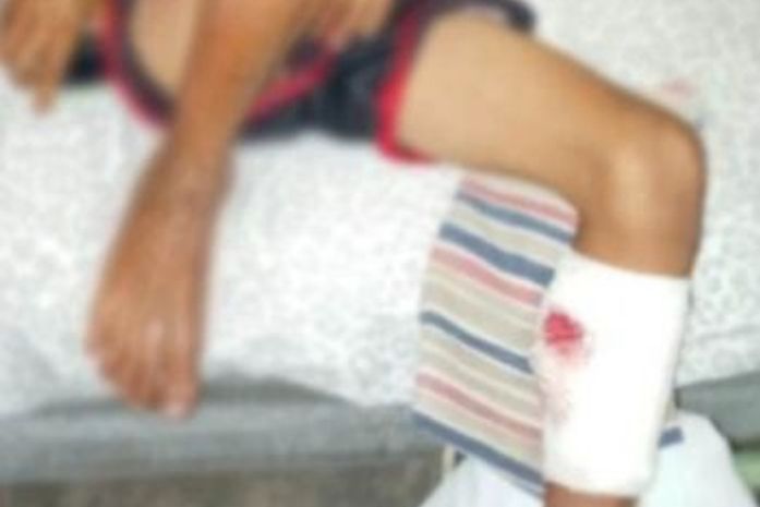 Meninos focavam baleados enquanto brincavam na frente de casa.